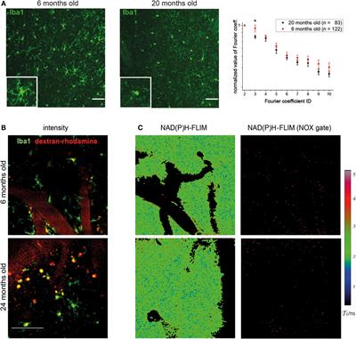 Analyzing Nicotinamide Adenine Dinucleotide Phosphate Oxidase Activation in Aging and Vascular Amyloid Pathology